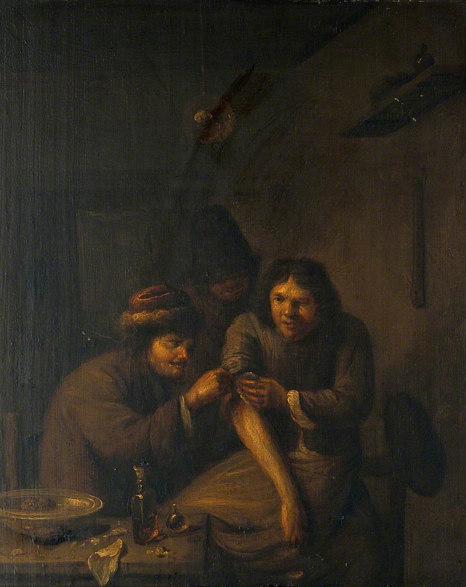 Un chirurgien soigne le bras d'un homme - Adriaen Brouwer image 1 reproduction artisanale de tableau